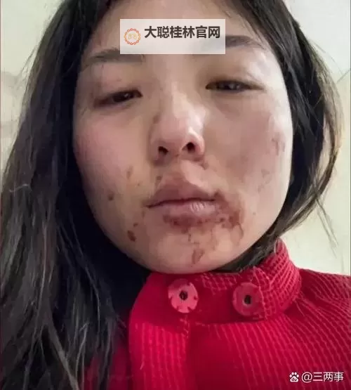 真实破外女摘花流血了:花园里的秘密与代价图1